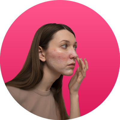 Oily Skin